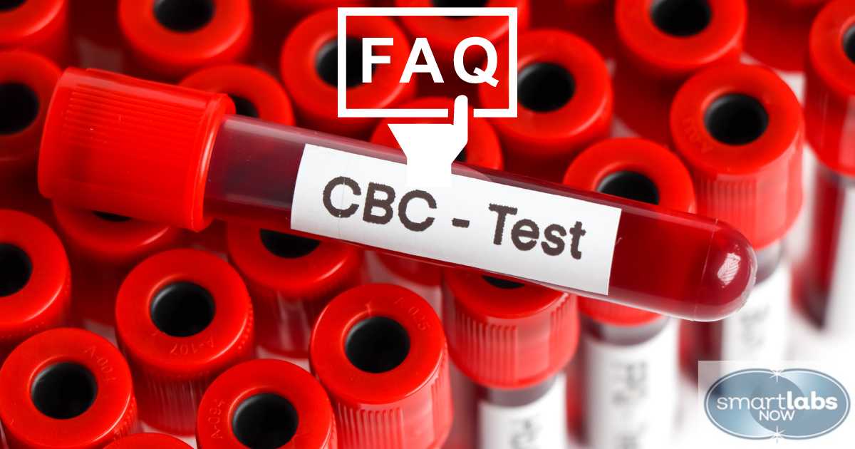 FAQs about CBC Testing - Answered