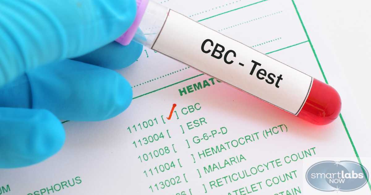 CBC Blood Test Imaging