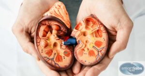 A model of human kidneys