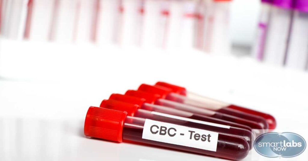 CBC Blood Tests: First-Order Diagnostics for Detecting Several Health Conditions