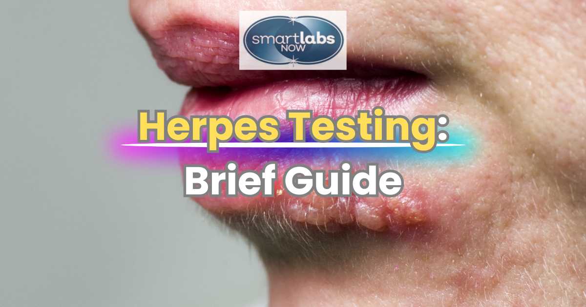 Herpes Testing Guide