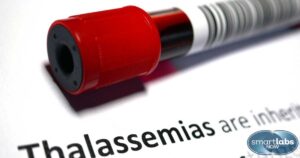 Thalassemia depiction