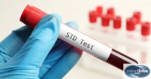 Types of STD Tests