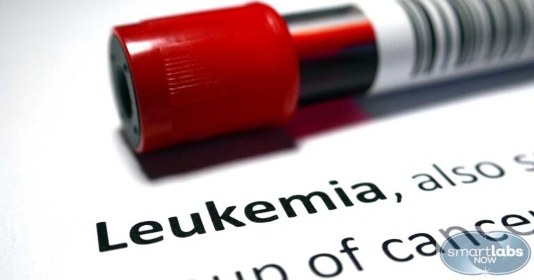 Which CBC Blood Tests May Indicate Cancer?