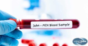 A patient's MCH blood sample