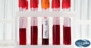 Several patients' STD blood samples.