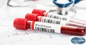 Recommended HBcAg and HBeAg test blood samples