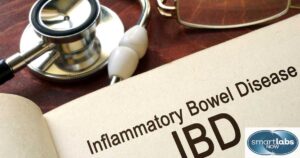 Inflammatory Bowl Disease