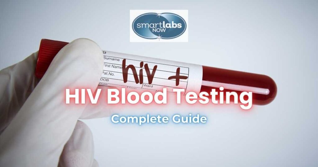 HIV Blood Testing Guide