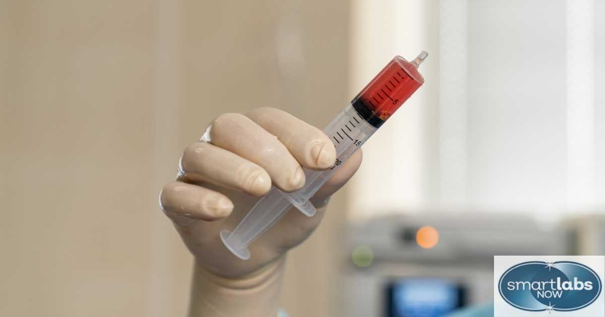 MPV Blood Test: Interpretation & Significance