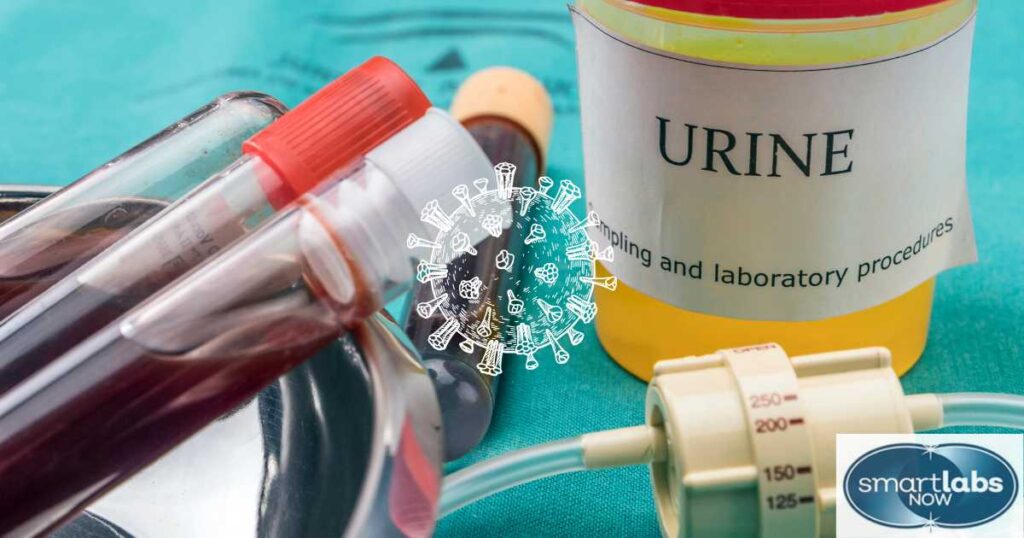 Urine Test Accuracy for Chlamydia & Gonorrhea