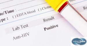 HIV test results document