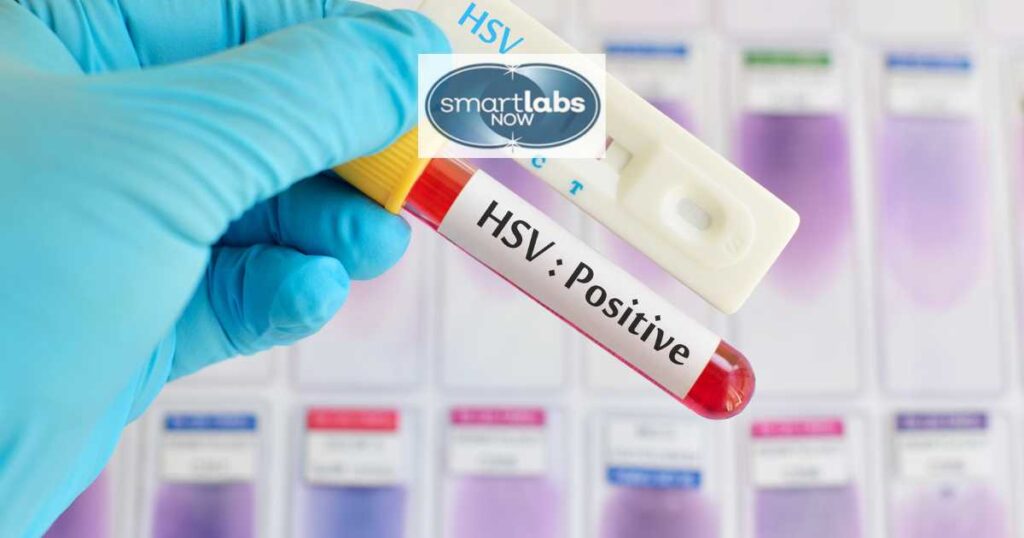 HSV-1 Test Results Interpretation Guide