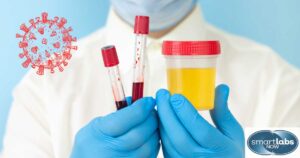 Urine STI test sample alongside two blood samples