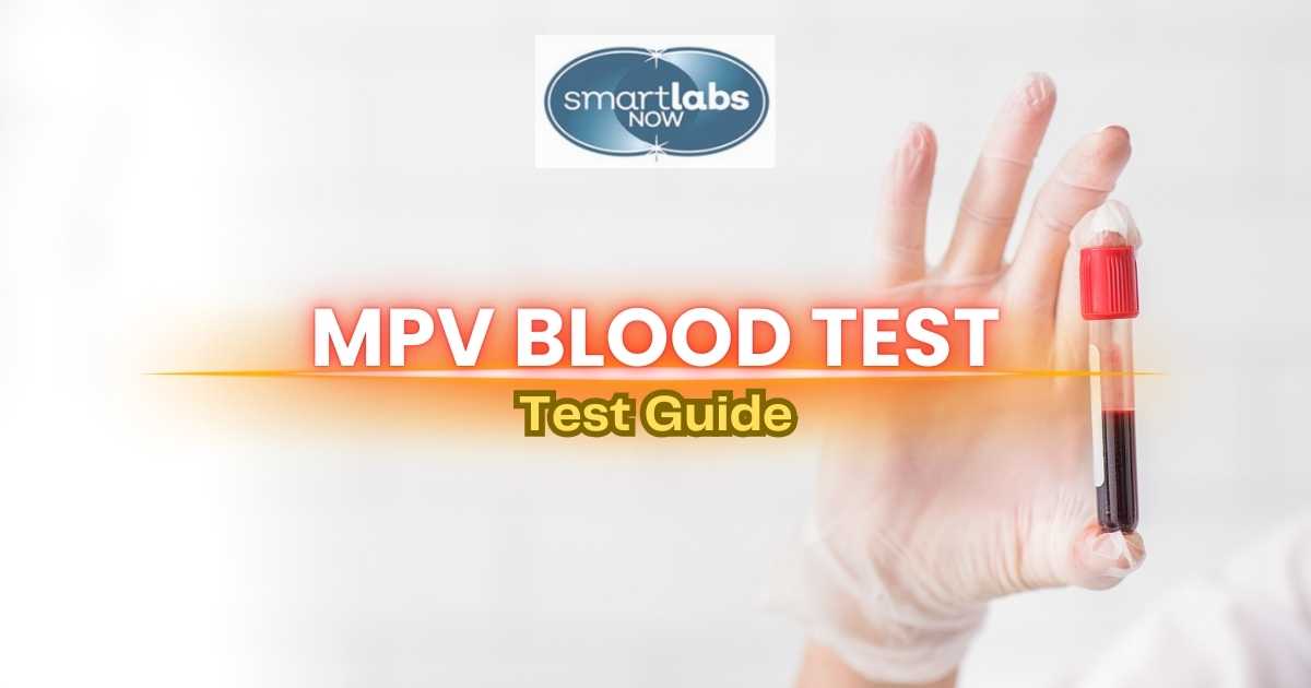 MPV Blood Test Guide