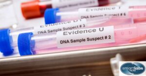 A collection of forensic DNA test samples taken from various people.