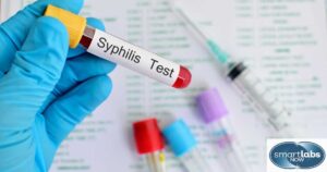 A syphilis blood test sample