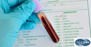 RDW testing along with other common CBC blood tests.