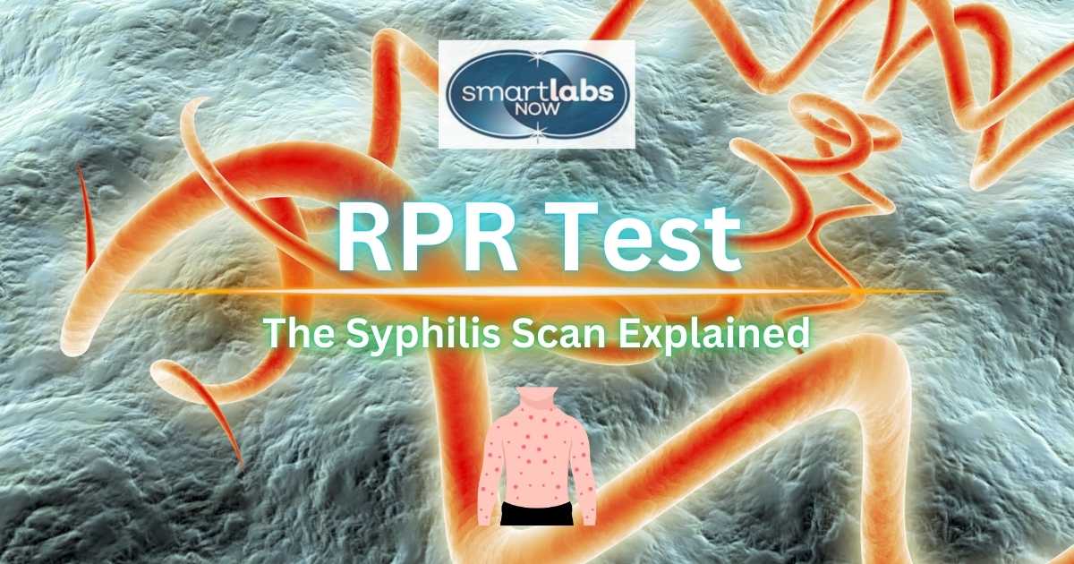 RPR/Syphilis Test Guide