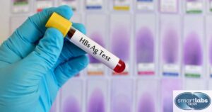 Why Hepatitis B Surface Antigen Testing May Be Necessary/Prescribed