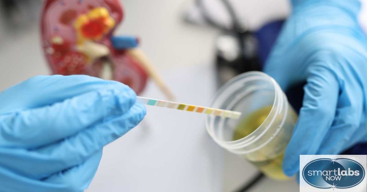 Gonorrhea Test: How It Works and What to Expect