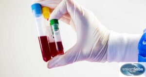 A lab technician holds different blood samples