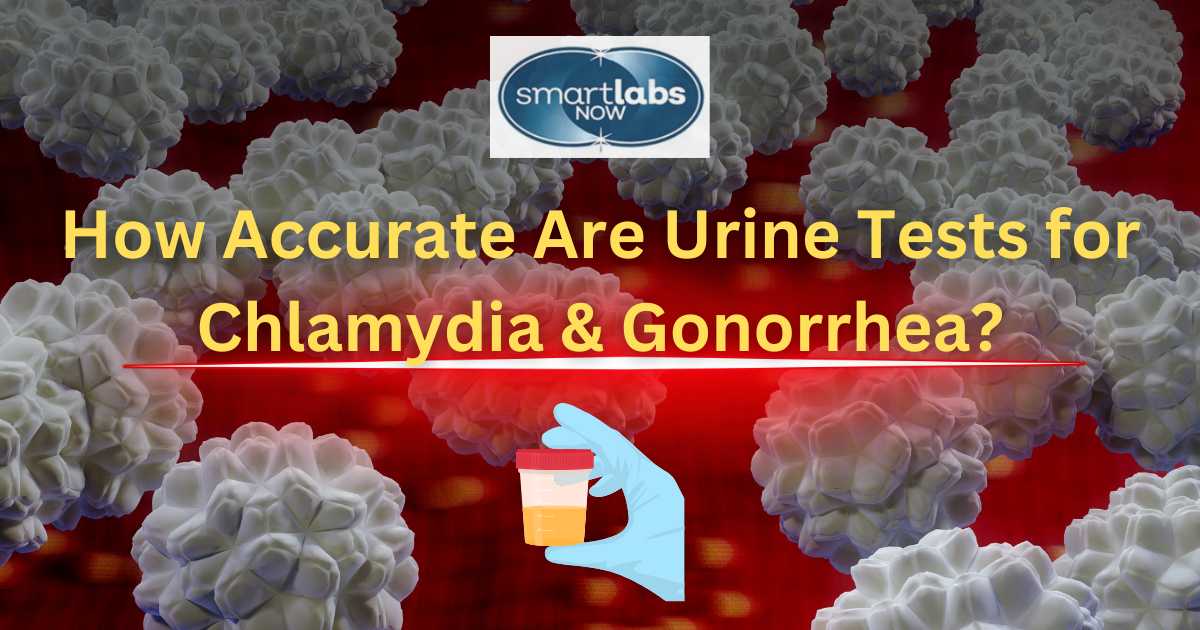 Urine Testing for Chlamydia and Gonorrhea Guide