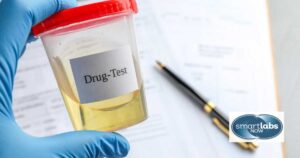 A urine drug test sample.