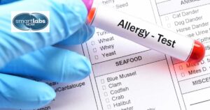 A blood allergy test sample.