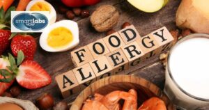 Food Allergy