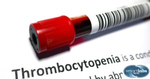 A patient's blood sample lying on an open medical text with the word 'Thrombocytopenia'.