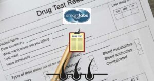 Drug test results.