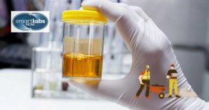 A urine sample taken for drug testing