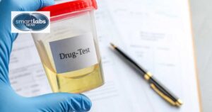 A urine sample for drug testing.