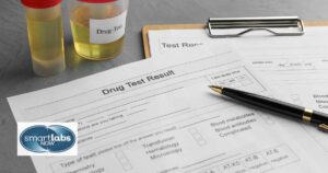 drug test results form