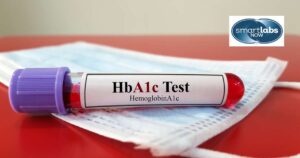 An HbA1c test blood sample.