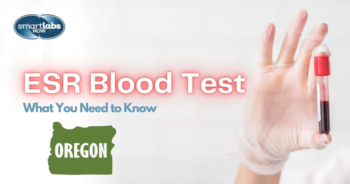 ESR Blood testing Portland, Oregon