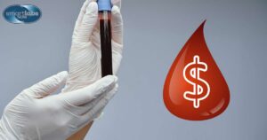 ESR Blood test Pricing Variations 