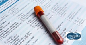 Interpreting HCT Blood Test Results.