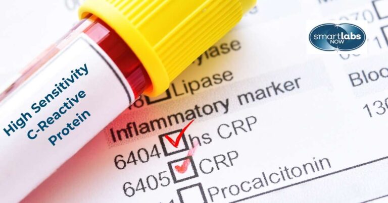 The High-Sensitivity C-Reactive Protein Blood Test