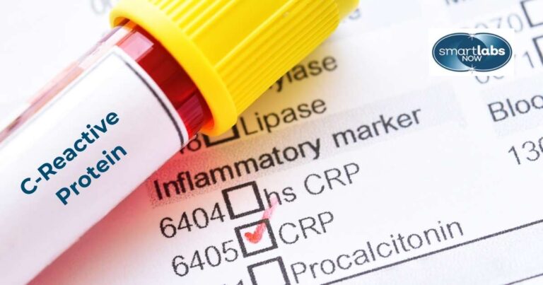 The CRP Blood Test