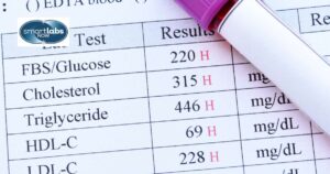 After DNA testing is completed, applicants and petitioners receive results that impact visa processing and immigration decisions.