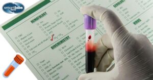 ESR Blood test specimen collection