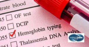 Hemoglobin Typing.