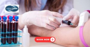 The magnesium blood test is typically straightforward, involving a simple blood sample collection to measure the amount of magnesium in your bloodstream.