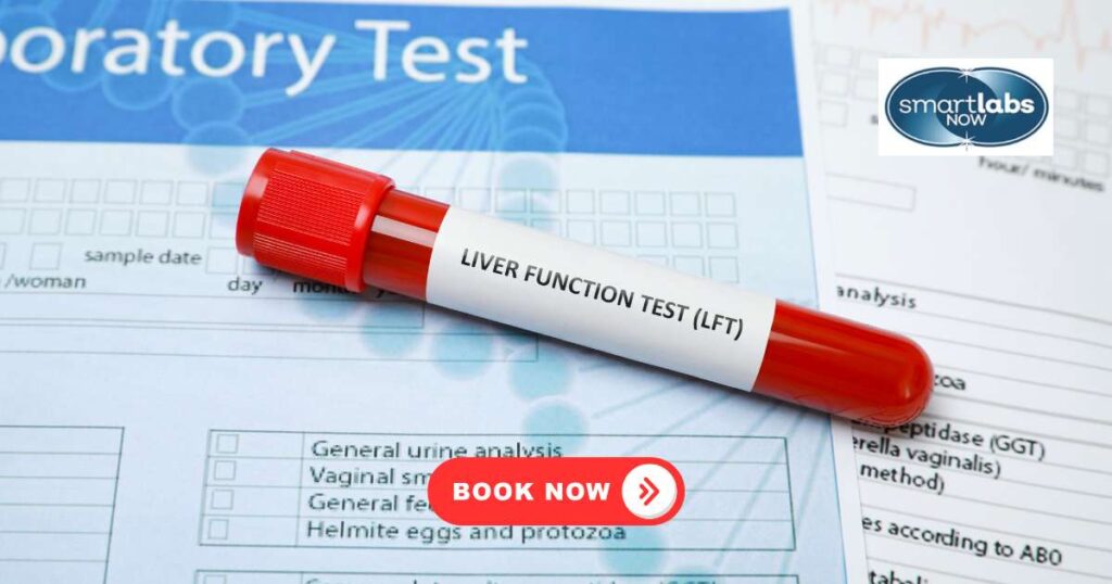 Liver Function Test (LFT) – Portland, Oregon - Smart Labs Now | Lab ...
