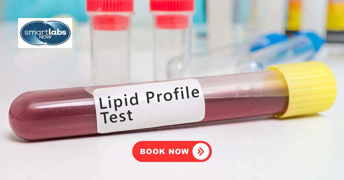 A lipid panel test measures the amount of cholesterol and triglyceride in a blood sample, delivering a detailed lipid profile that reveals your cholesterol level and other fat markers.