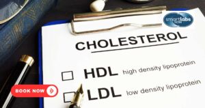 LDL cholesterol (low‑density lipoprotein), known as “bad cholesterol,” carries cholesterol particles through the blood and can build up in the walls of arteries, leading to heart attack or stroke.